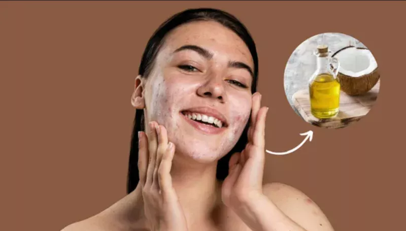 Dầu dừa có thể hỗ trợ làm mềm bề mặt da khô, từ đó giúp da trông bớt sần sùi và xỉn màu.