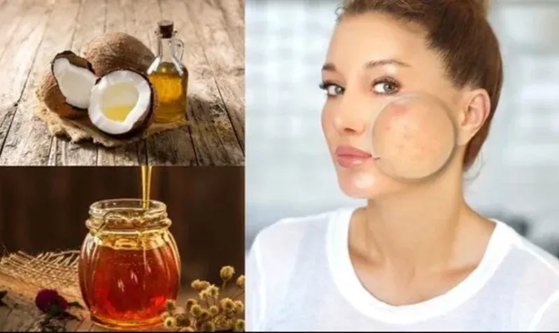 Khi kết hợp dầu dừa và mật ong, nên dùng lượng vừa phải và tránh pha quá nhiều thành phần khác cùng lúc.